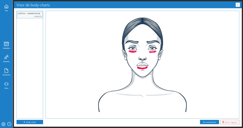 Explicacion Body Chart