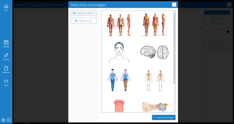 Configuración Body Charts