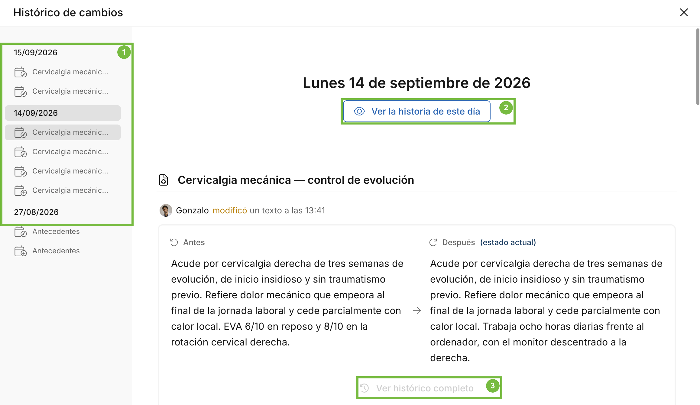 Ventana Histórico de cambios con la lista de días a la izquierda y la comparación Antes y Después de un texto en Archivex